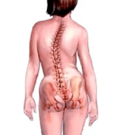 Pathologie des muskuloskeletischen Systems