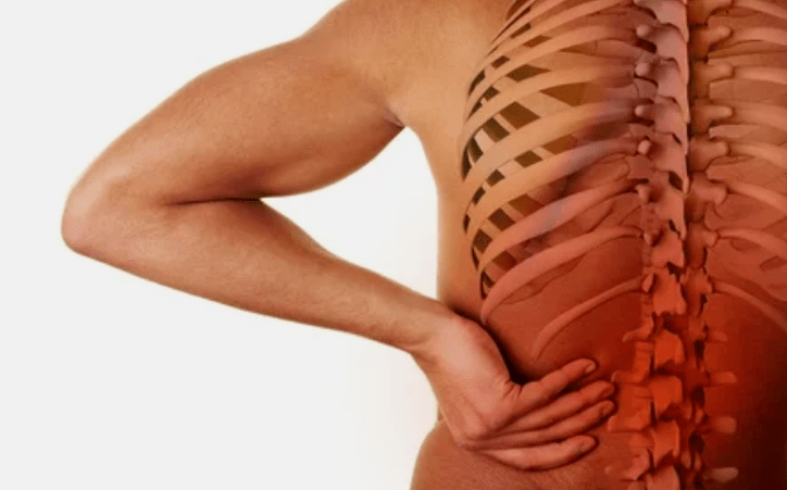 Die Ursachen der lumbalen Osteochondrose