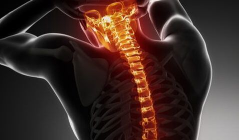 Osteochondrose der gesamten Säule