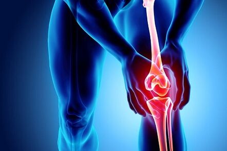 Arthrose