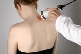 Cervical Osteochondrosisbehandlung mit Lasertherapie