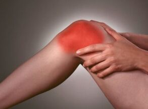 Das Symptom einer Arthrose ist ein starker Schmerz im Kniebereich.