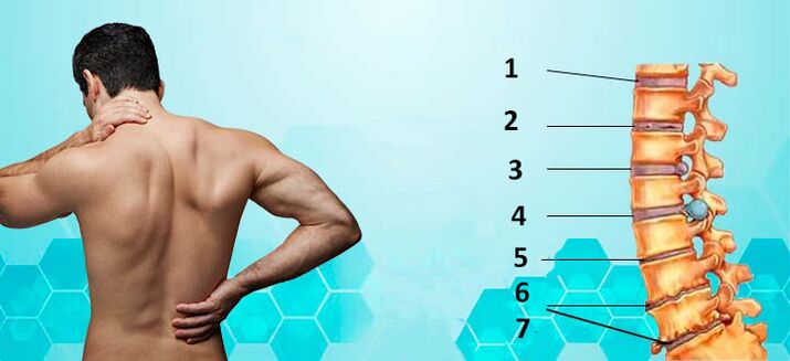 Entwicklungsstadien der Osteochondrose